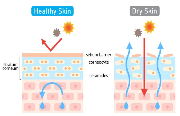 ceramides skin barrier function diagram
